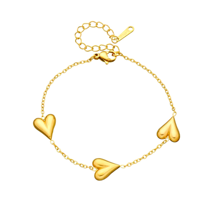 Lovely armband